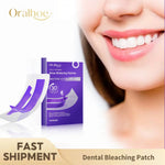 Professional Teeth Whitening Strips for a Brighter Smile