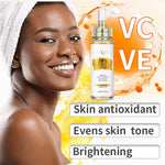 AILKE Vitamin C Set, Reduce Dark Spots, with Lightening Body Lotion, Even Tone Face Cream, Whitening Serum, Brightening Soap