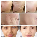Calcium Volume Multi Balm Stick Collagen Hydrating Anti Aging Firming Brightening Fade Fine Lines Nourishing Facial Skin Care