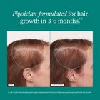 Nutrafol Women's Balance Hair Growth Supplement for Women 45+
